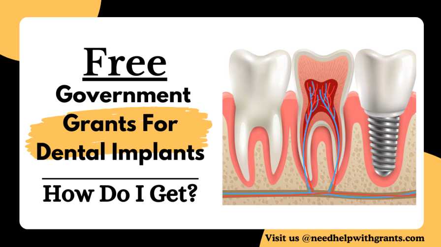 Free Government Grants For Dental Implants